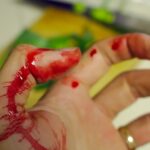 Read more about the article First Aid for Cuts and Scrapes