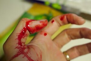 Read more about the article First Aid for Cuts and Scrapes
