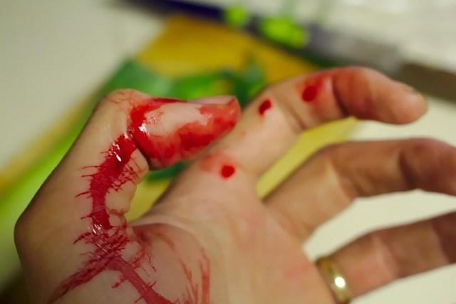 You are currently viewing First Aid for Cuts and Scrapes